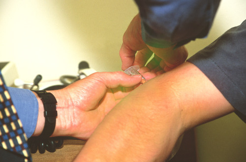 Illustrasjonsfoto Science Photo Library/NTB scanpix