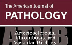 Artiklene er publisert i tidsskriftene American Journal of Pathology og Arteriosclerosis, Thrombosis, and Vascular Biology