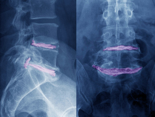 Illustrasjonsfoto Science Photo Library/NTB scanpix