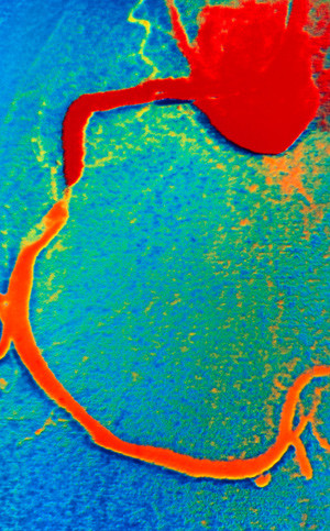 Illustrasjonsfoto Science Photo Library/NTB scanpix