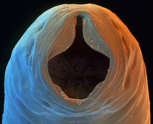 Illustrasjonsfoto Science Photo Library/NTB scanpix