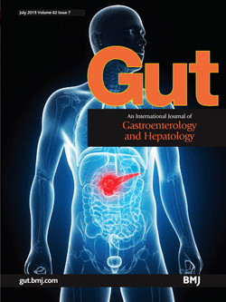 Artikkelen ble nylig publisert i Gut, et av de mest anerkjente gastroenterologiske tidsskriftene.