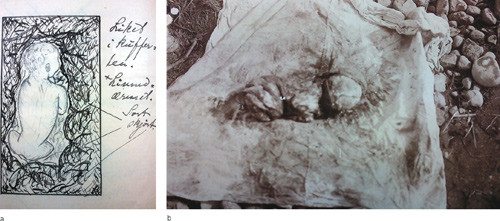 Figur 3  a) Tegning av barnelik funnet i koffert p&aring; siktedes v&aelig;relse om vinteren. Liket var dypfryst og m&aring;tte tines ved&hellip;