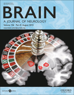 Studien ble e-publisert 26.4. 2013 i det prestisjetunge nevrologiske tidsskriftet Brain