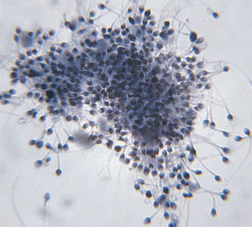 Illustrasjonsfoto NTB scanpix