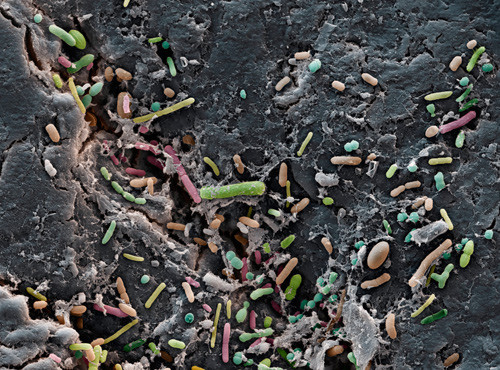 Illustrasjonsfoto Science Photo Library/NTB scanpix