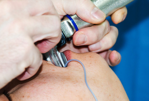 Illustrasjonsfoto NTB scanpix