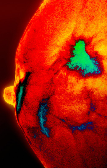 Illustrasjonsfoto: Sciencephoto/NTB scanpix