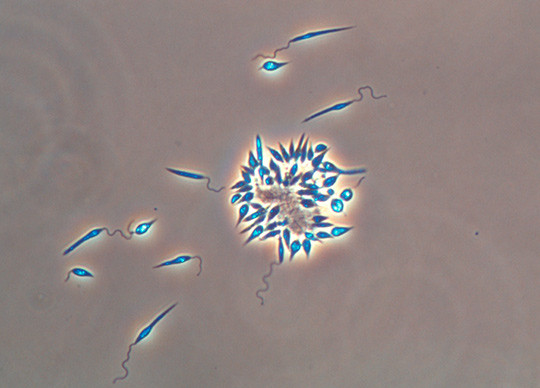 Illustrasjonsfoto: Science Photo Library/NTB scanpix