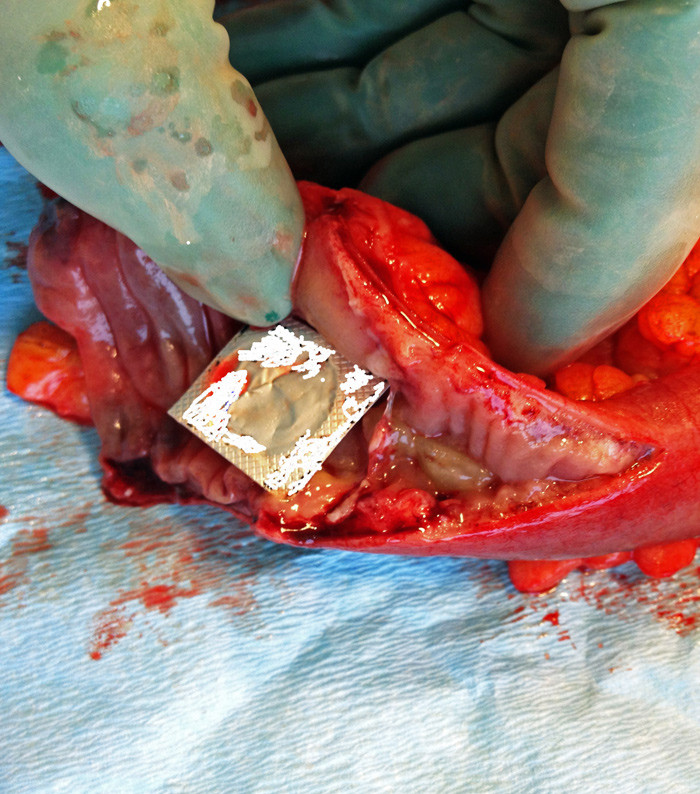 Figur 3  Foto av tablett i blisterpakning (retusjert for &aring; unng&aring; identifikasjon av varemerke) i &aring;pnet tynntarm, med&hellip;