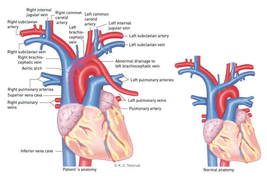 Figure 3  Normal anatomy versus patient's anatomy 