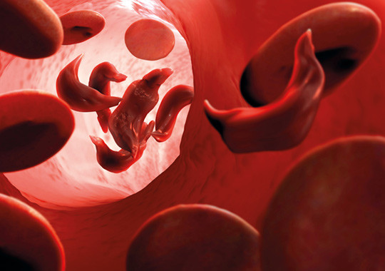 Illustrasjonsfoto: Science Photo Library