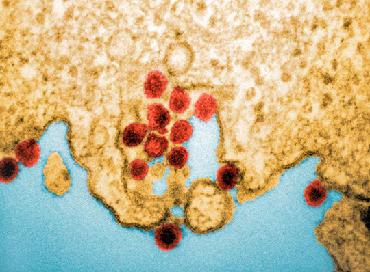 Illustrasjonsfoto: Science Photo Library