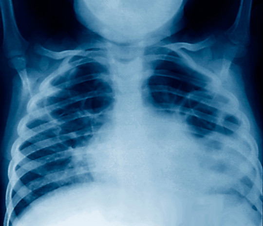 Illustrasjonsfoto: Science Photo Library