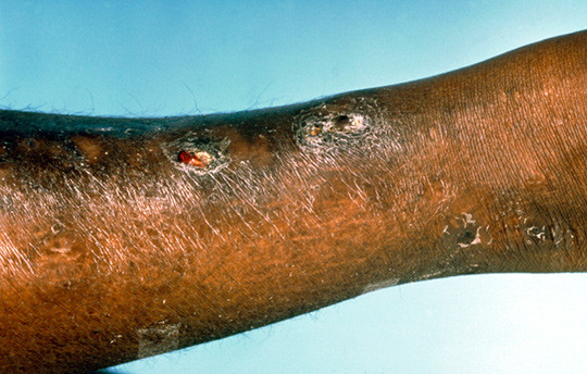 Illustrasjonsfoto: Science Photo Library