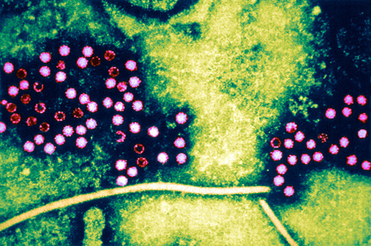 Illustrasjonsfoto: Science Photo Library