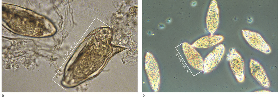 Figur 2  a) Egg fra S. mansoni. Foto: Corbis/Scanpix. b) Egg fra S. haematobium. Foto: Science Photo Library