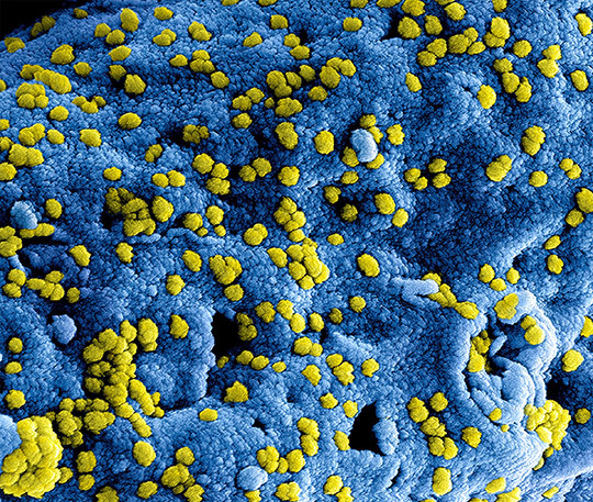 Illustrasjonsfoto: Demotix/NTB scanpix