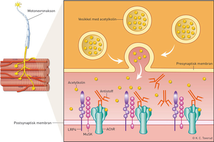 Figur 1  Acetylkolin frigj&oslash;res presynaptisk som respons p&aring; et aksjonspotensial i motonevronet. Ved binding av acetylkolinet&hellip;