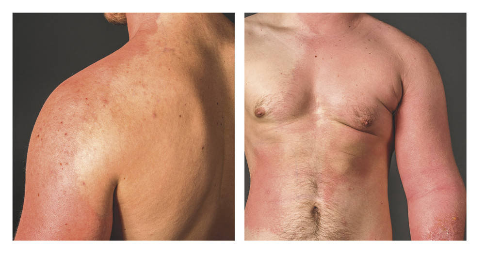 Begge foto: &Oslash;ystein H. Horgmo, Universitetet i Oslo