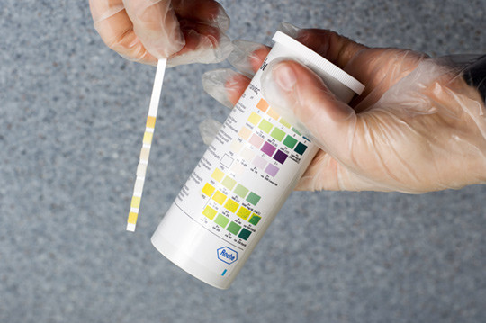 Illustrasjonsfoto: Science Photo Library