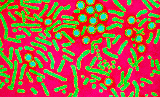 Farget elektronisk mikrofotografi (coloured transmission electron micrograph, TEM) av hepatitt B-viruset og dets antigen. De&hellip;