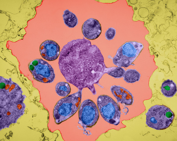 Plasmodium falciparum. Foto: Science Photo Library