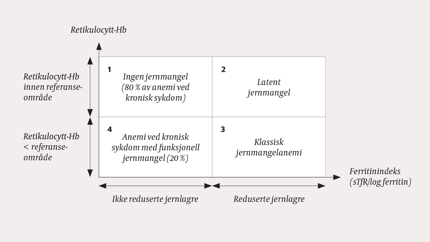 Figur 2 Algoritme basert p&aring; retikulocytthemoglobin og ferritinindeks til hjelp for &aring; skille mellom ulike jernrelaterte&hellip;