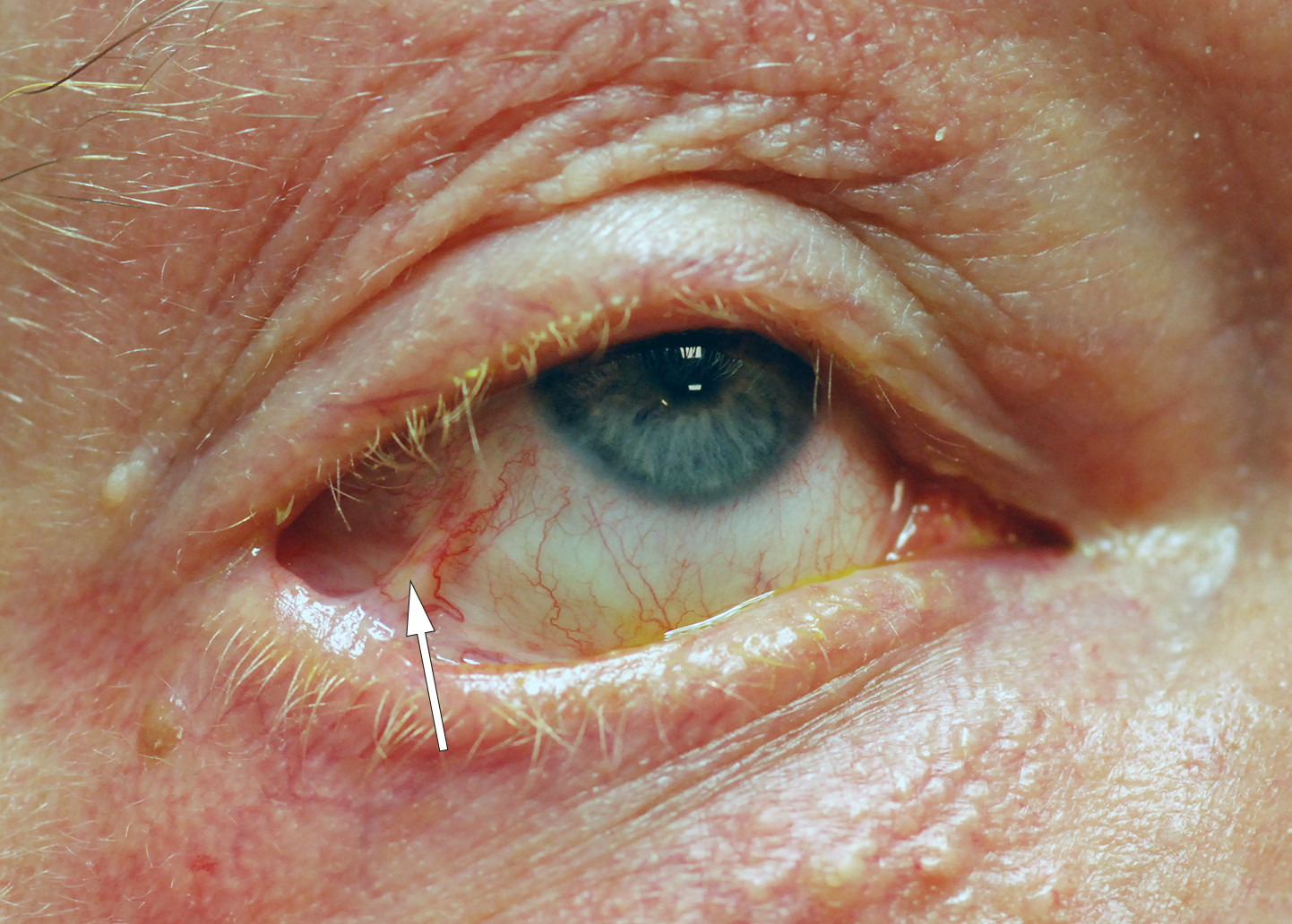 Foto: Geir Aksel Qvale