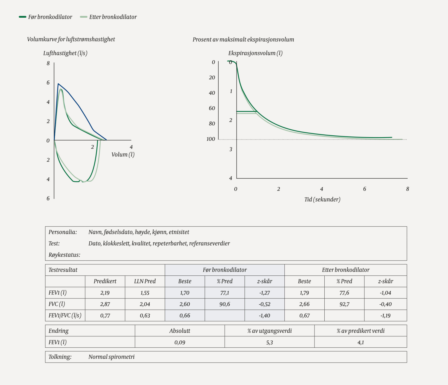Figur 1 Forslag til utskrift av spirometri. Utover vanlige m&aring;l inkluderes LLN Pred (predikert nedre normalgrense), z-sk&aring;r og&hellip;