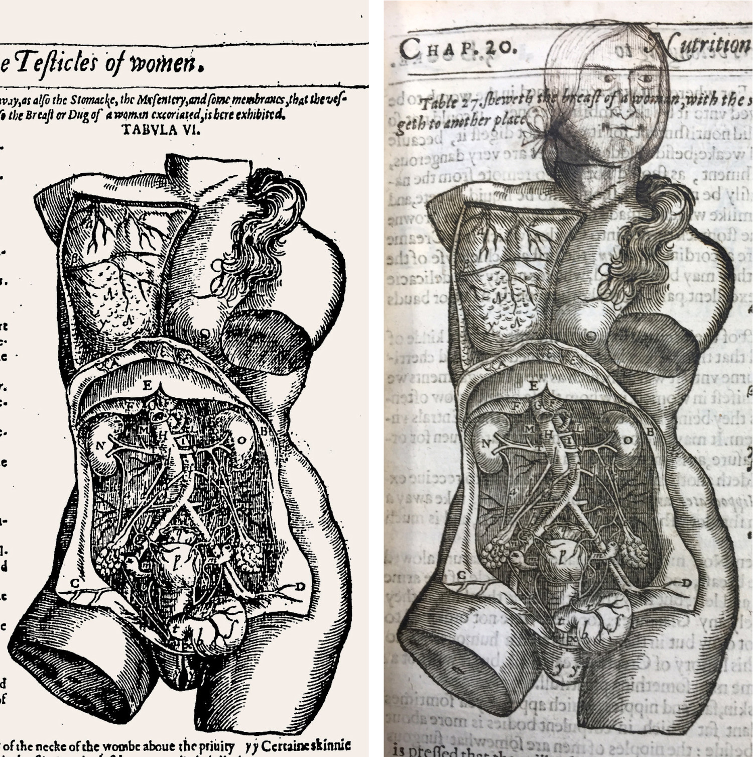 Figure 1 The figure shows a female torso in two different editions of the book Mikrokosmographia: A Description of the Body&hellip;
