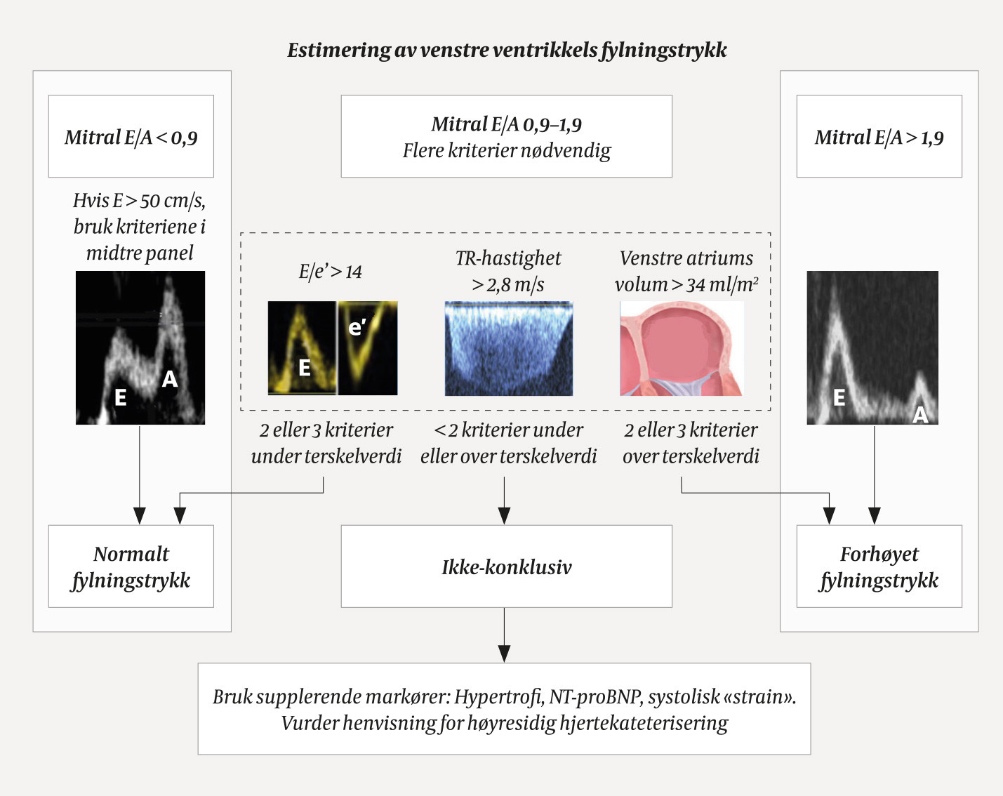 Figur 5 Skjematisk fremstilling av hvordan ekkokardiografi brukes til &aring; estimere venstre ventrikkels fylningstrykk. I&hellip;