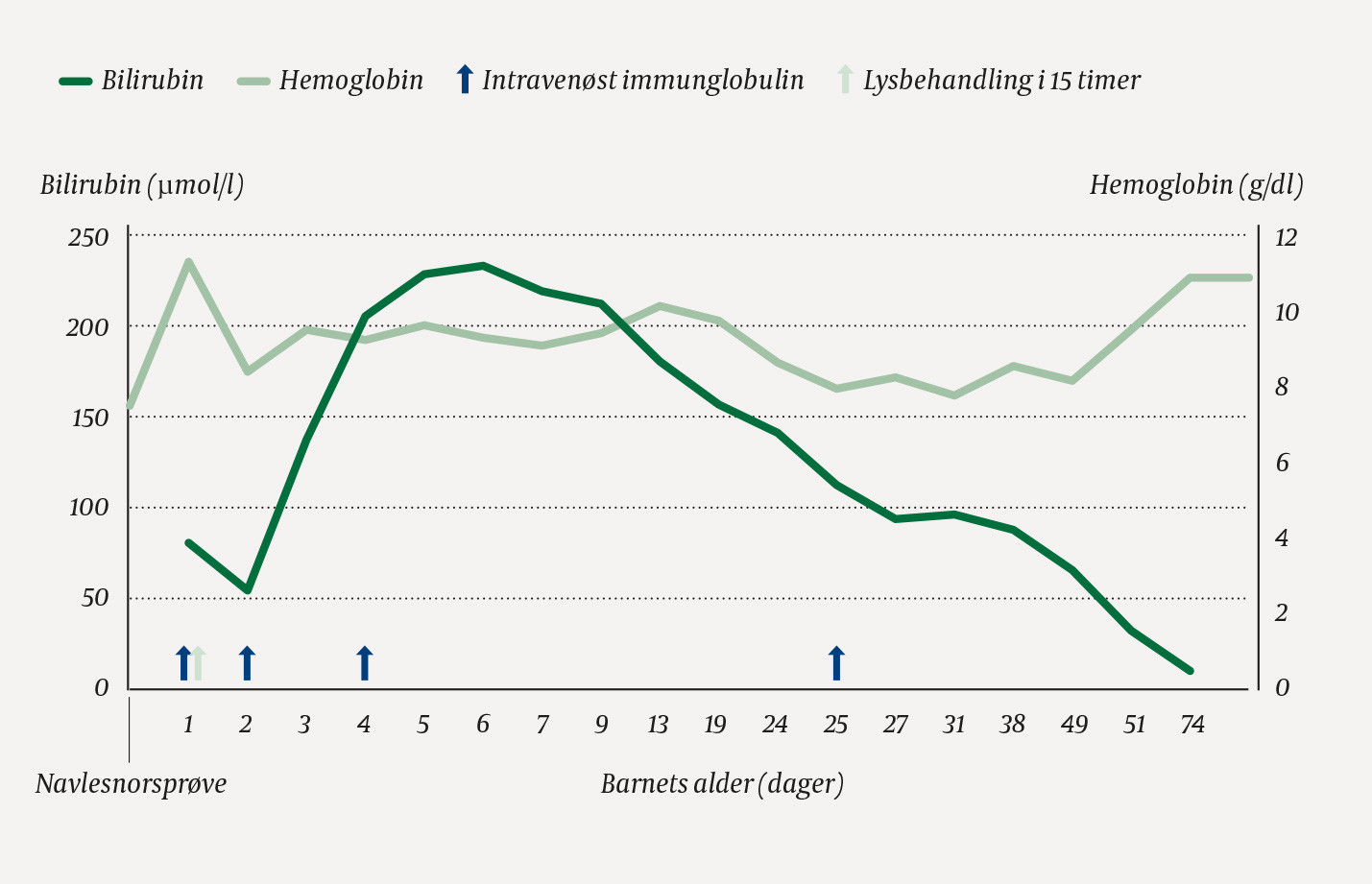 Figur 2 Bilirubin- og hemoglobinverdier hos den nyf&oslash;dte. Behandling med intraven&oslash;st immunglobulin (to f&oslash;rste doser: 0,5 g/kg&hellip;