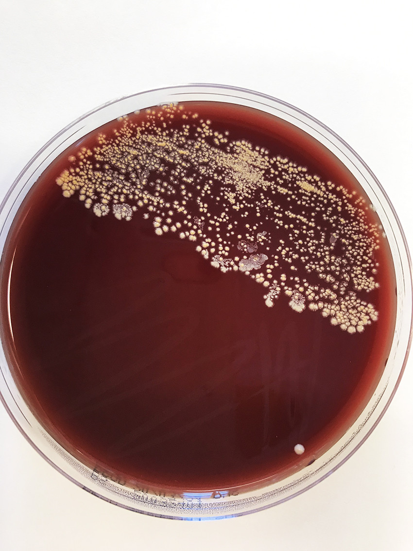 Figure 3 Inoculate from cerebral abscess on blood agar with pigmented colonies. Photo: Else Quist-Paulsen.