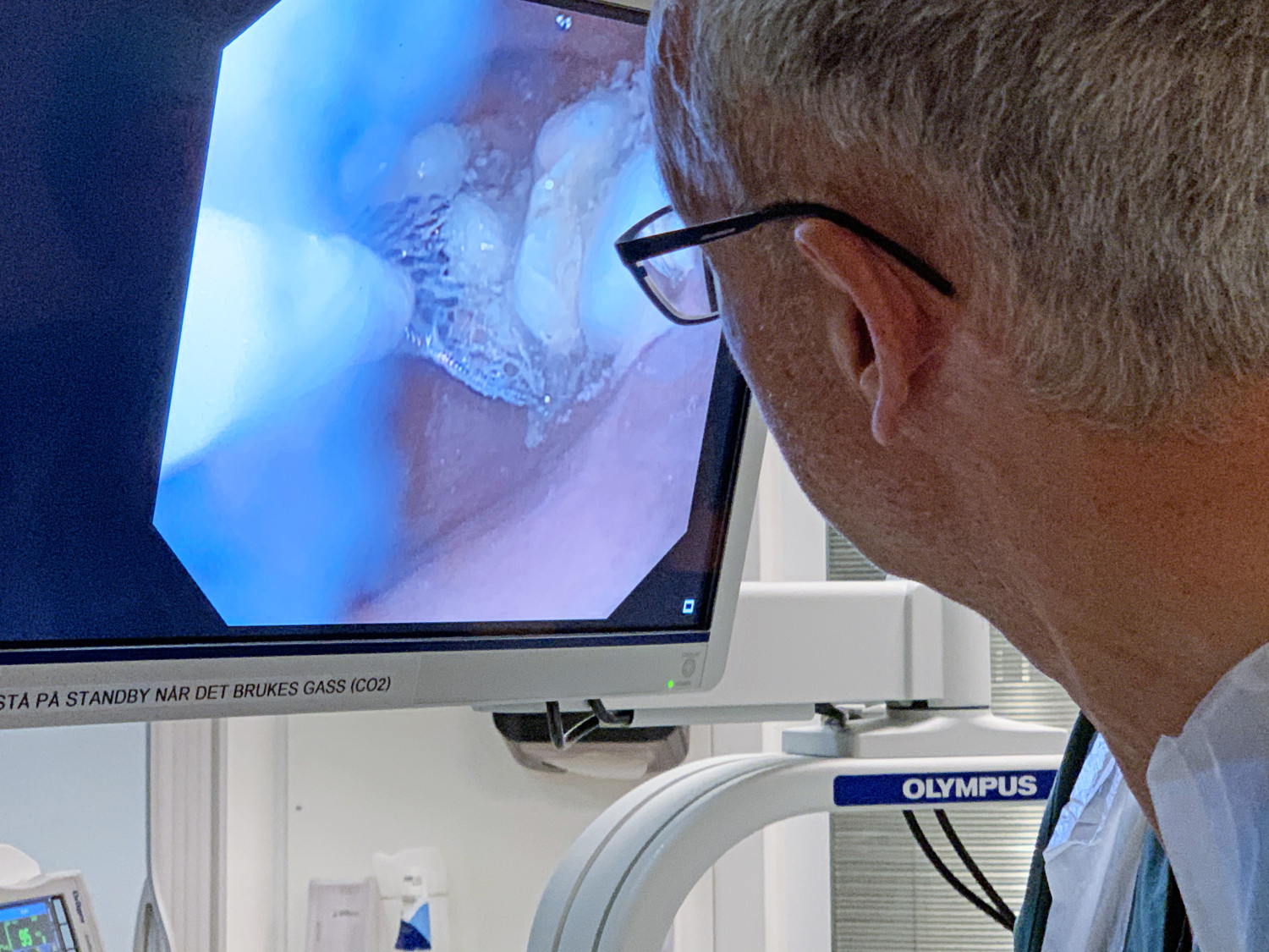 Figure 1 Monitor shows pharmacobezoar in the snare as well as some standalone tablets.