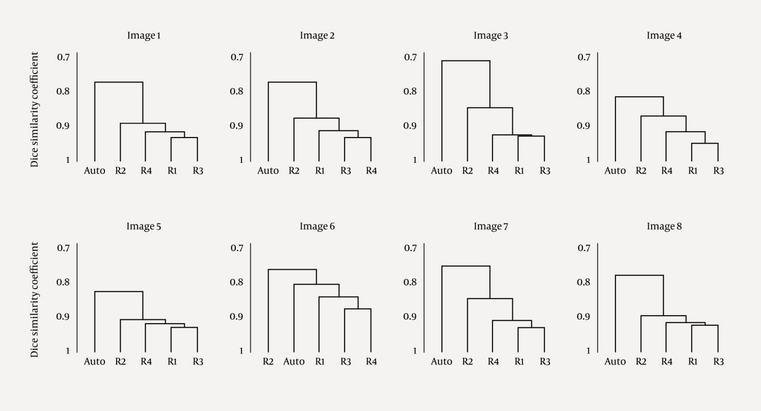 Figure 1 Dendrograms from an agglomerative hierarchical cluster analysis based on data from R&oslash;islien and Samset (1). Four&hellip;