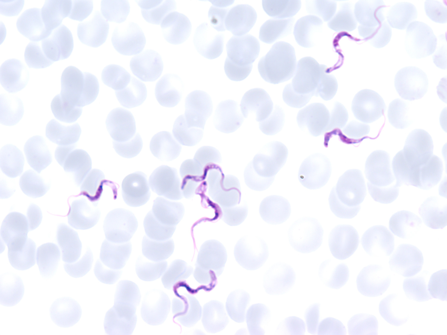 Figure 1 Trypanosoma brucei rhodesiense in blood smears. Photo: Bj&oslash;rn Blomberg