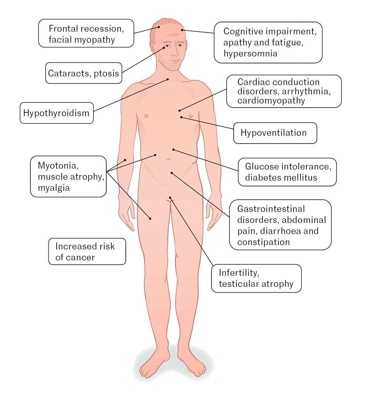 Figure 1 Myotonic dystrophy type 1 is a multiorgan disorder. The figure shows the organ systems that can be affected.