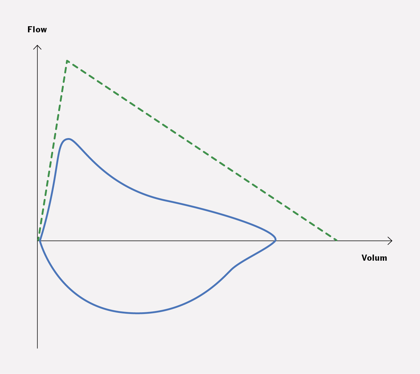 Figur 2 Eksempel p&aring; hvordan en spirometrikurve kan se ut ved trakeobronkomalasi, der den stiplede kurven er referansekurven&hellip;