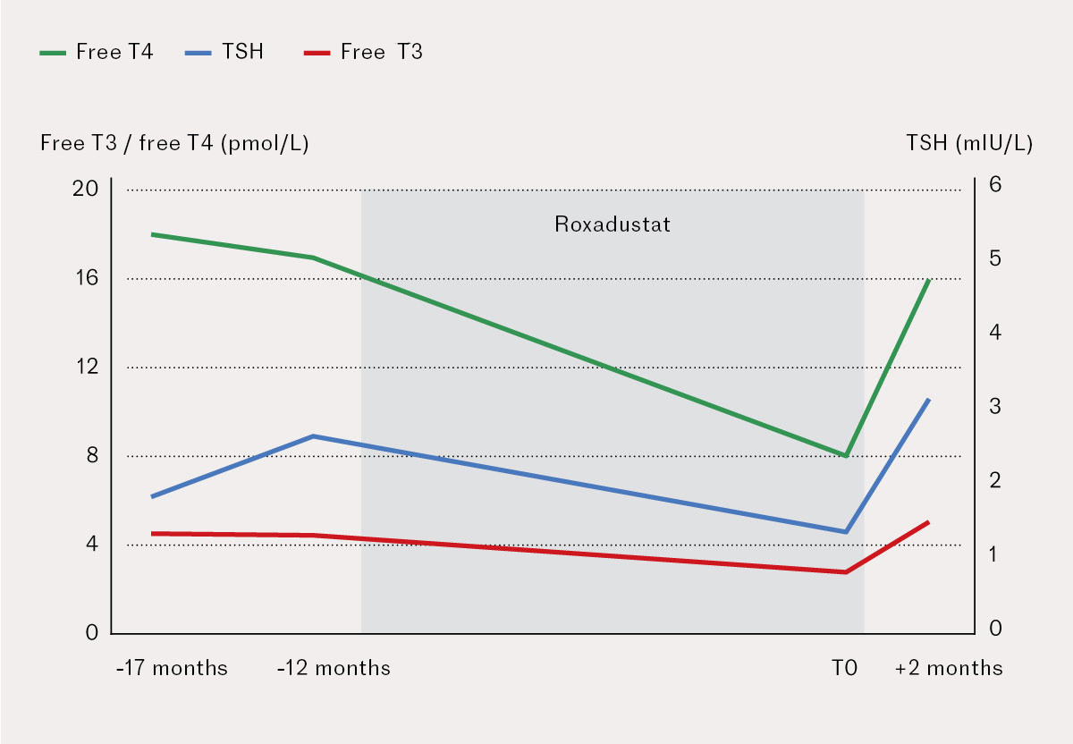 Figure 1 Thyroid function tests before, during and after treatment with roxadustat in a woman in her sixties with chronic&hellip;