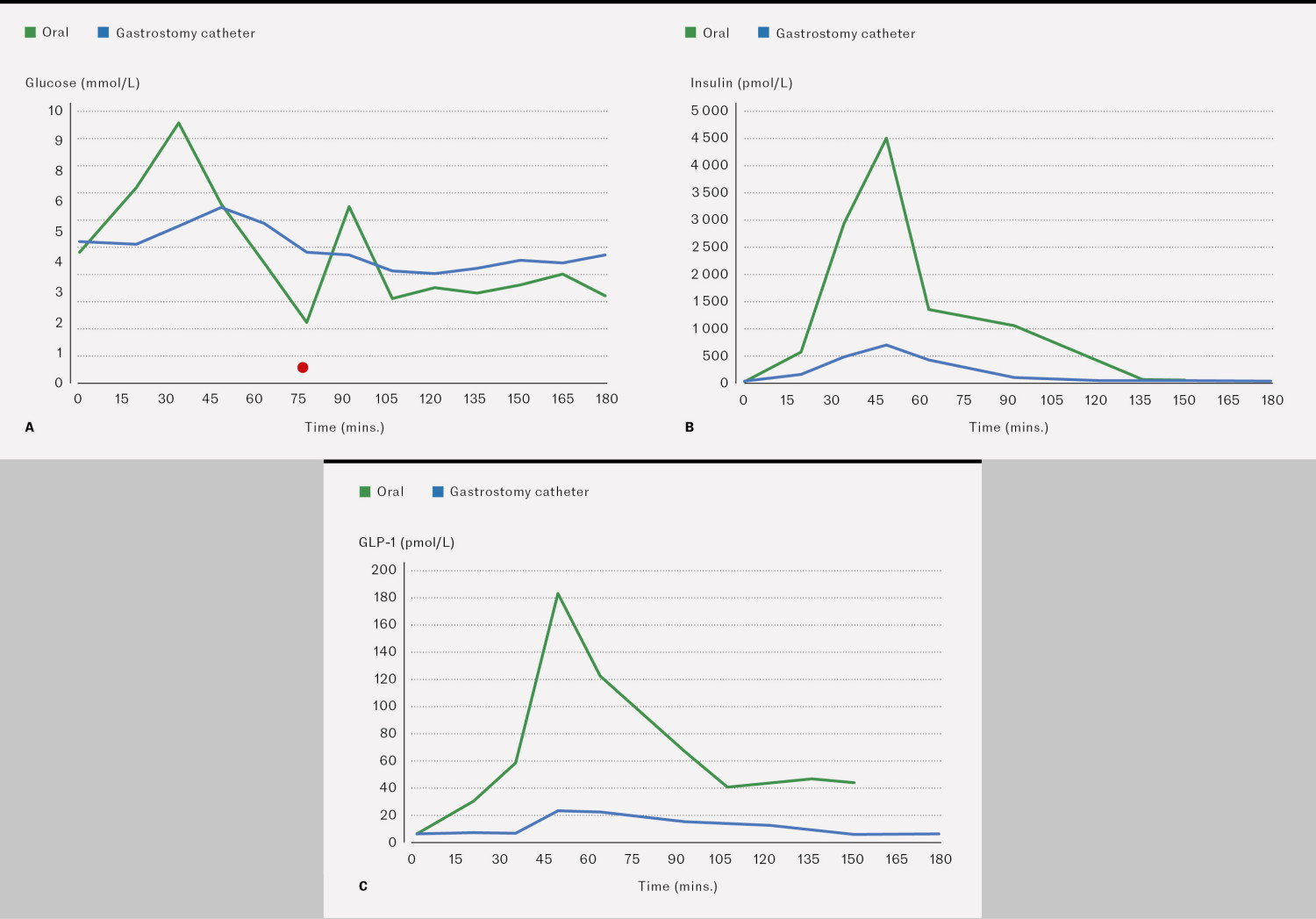 Figure 1 Meal test in a patient with hypoglycaemia after gastric bypass, with measurements of plasma glucose levels (a),&hellip;
