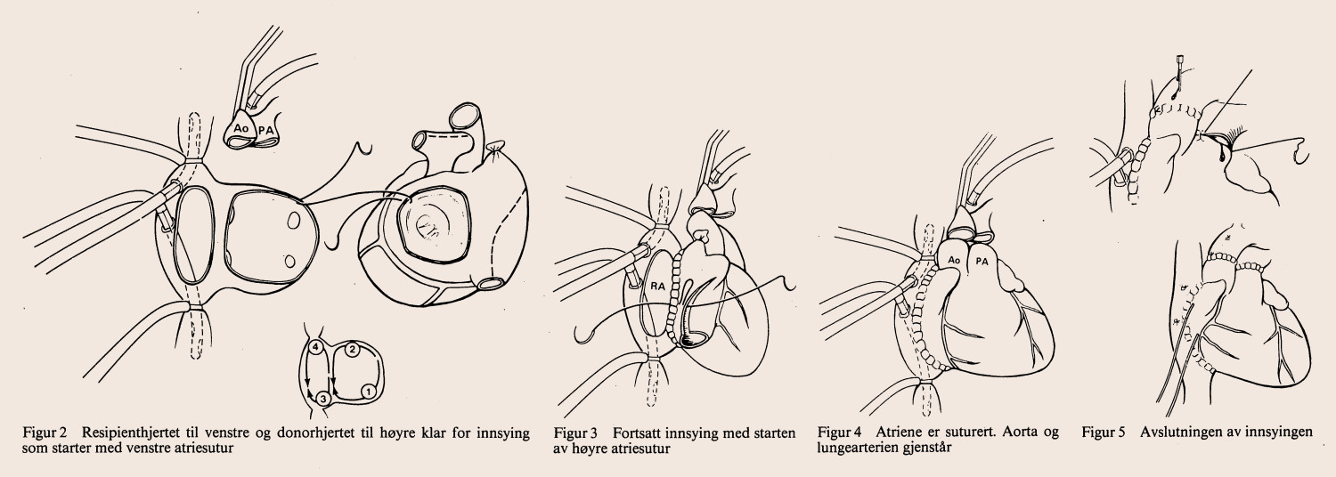 Figur 2&ndash;5. Faksimile, tilpasset av Tidsskriftet.