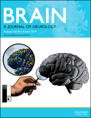 Studien er publisert i tidsskriftet Brain.