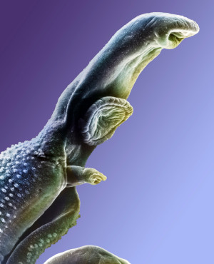 Illustrasjon: Science photo library / NTB Scanpix