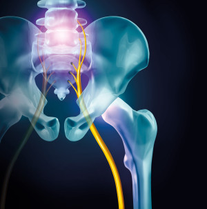 Illustrasjon: wildpixel/iStock