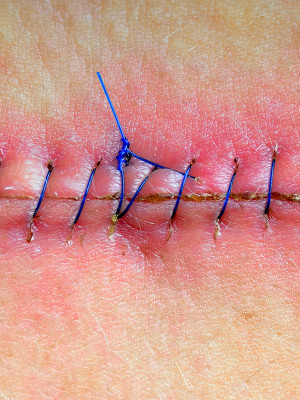 Foto: scholes1 / iStock