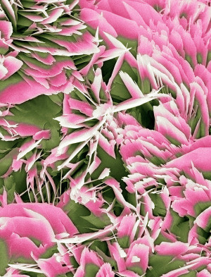 Nyresteinkrystaller sett ved elektronmikroskop (SEM). Illustrasjonsfoto: Science Photo Library / NTB