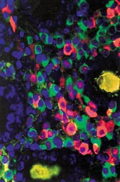 Figur 4   Med forskjellige visualiseringsmetoder, som for eksempel in situ-hybridisering, kan b&aring;de muterte og normale gener&hellip;