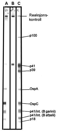 Figur 2   Immunblot som viser IgM-reaktivitet mot rekombinant framstilte antigen fr&aring; B burgdorferi. Antigena er immobilisert&hellip;