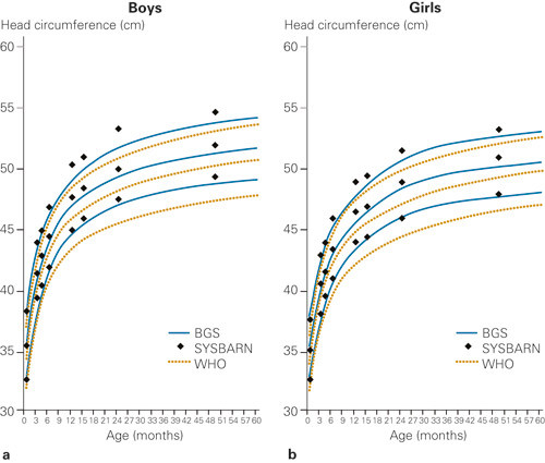 Figure 3  Comparison between head circumference-for-age from new Norwegian growth charts (based on the Bergen Growth Study)&hellip;